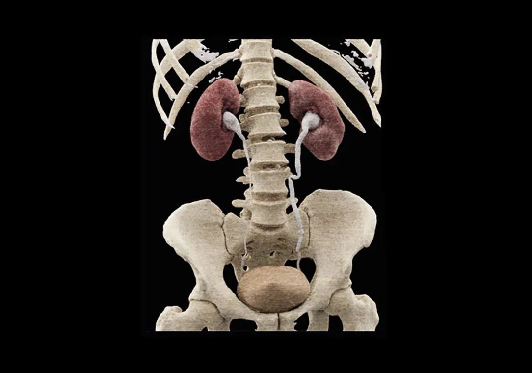 A three-dimensional image of a human skeleton showing the ribs, spine, pelvis, and kidneys.